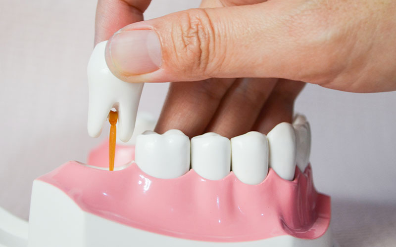 Understanding the Benefits of Dental Implants for Tooth Replacement Benefits of Dental Implants