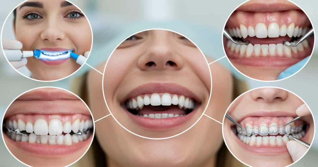 Exploring the Various Options in Cosmetic Dentistry Cosmetic Dentistry