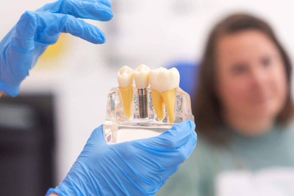 What To Expect Before, During, and After Dental Implant Surgery Dental Implant Surgery