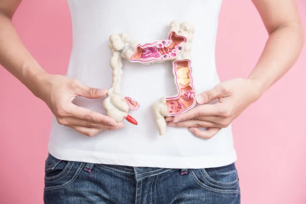 Ulcerative Colitis Treatment