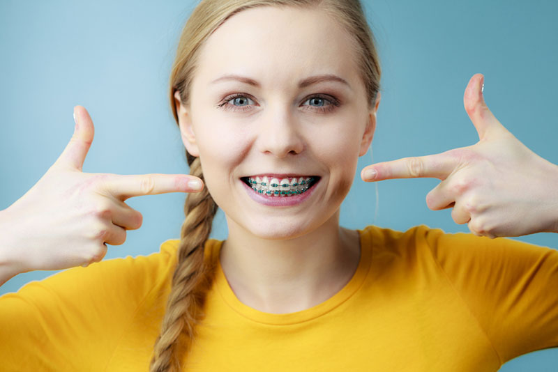 What to Expect When Getting Braces Getting Braces